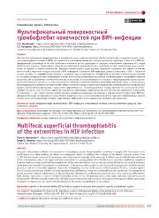 Мультифокальный поверхностный тромбофлебит конечностей при ВИЧ-инфекции