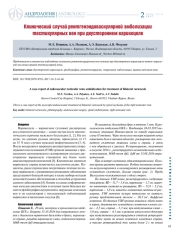 Клинический случай рентгенэндоваскулярной эмболизации тестикулярных вен при двустороннем варикоцеле