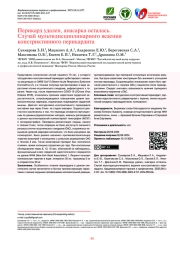 Перикард удален, анасарка осталась. Случай мультидисциплинарного ведения констриктивного перикардита