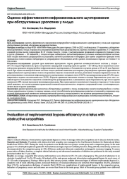 Оценка эффективности нефроамниального шунтирования при обструктивных уропатиях у плода