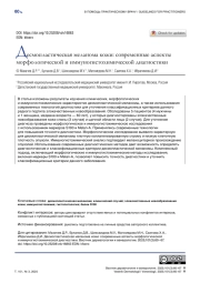 Десмопластическая меланома кожи: современные аспекты морфологической и иммуногистохимической диагностики