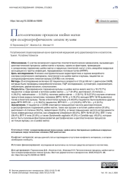 ПАТОЛОГИЧЕСКИЕ ПРОЦЕССЫ ШЕЙКИ МАТКИ ПРИ СКЛЕРОАТРОФИЧЕСКОМ ЛИХЕНЕ ВУЛЬВЫ
