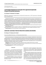 САРКОИДОПОДОБНАЯ РЕАКЦИЯ ПРИ АДЕНОКАРЦИНОМЕ ПРЕДСТАТЕЛЬНОЙ ЖЕЛЕЗЫ