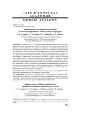 АНГИОСАРКОМЫ РАЗЛИЧНОЙ ЛОКАЛИЗАЦИИ: МЕТААНАЛИЗ СОВРЕМЕННЫХ ДАННЫХ (ОБЗОР ЛИТЕРАТУРЫ)