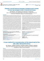 Новый способ реконструкции латеральной стенки аттика при раздельной аттикоантротомии
