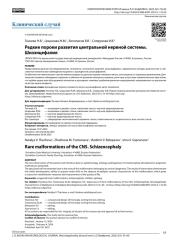 Редкие пороки развития центральной нервной системы. Шизэнцефалия