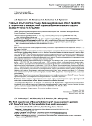 Первый опыт имплантации браншированных стент-графтов у пациентов с аневризмой торакоабдоминального отдела аорты IV типа по Crawford