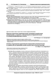 Индукция пароксизма наджелудочковой тахикардии воздействием электротравмы у пациента с имплантируемым кардиомонитором по поводу рецидивирующих синкопе