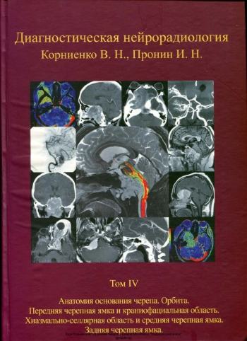 Диагностическая нейрорадиология. Том 4
